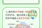 制造肩膀的步骤是什么？需要哪些材料？