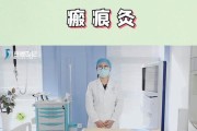 录痕装备的使用方法是什么？