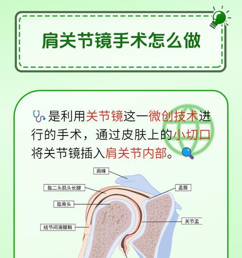 制造肩膀的步骤是什么？需要哪些材料？