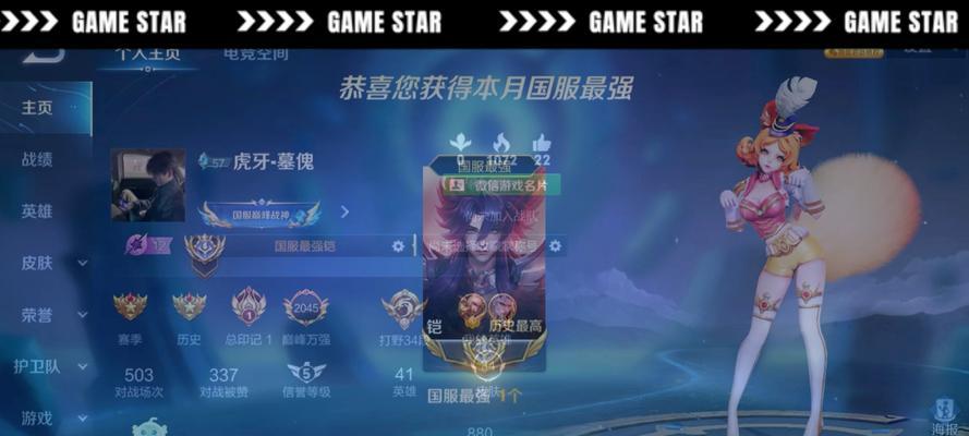 王者荣耀中恺的兑换条件是什么？